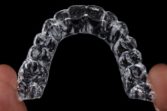 invisalign stockholm